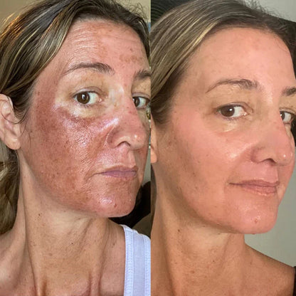Glass Skin Premium Kit (6 Stück)™