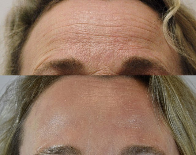 Collagen Boost Set