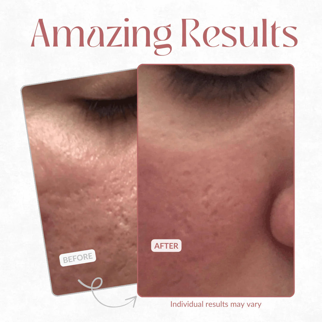 CACTOX Pore Relief Multi Balm