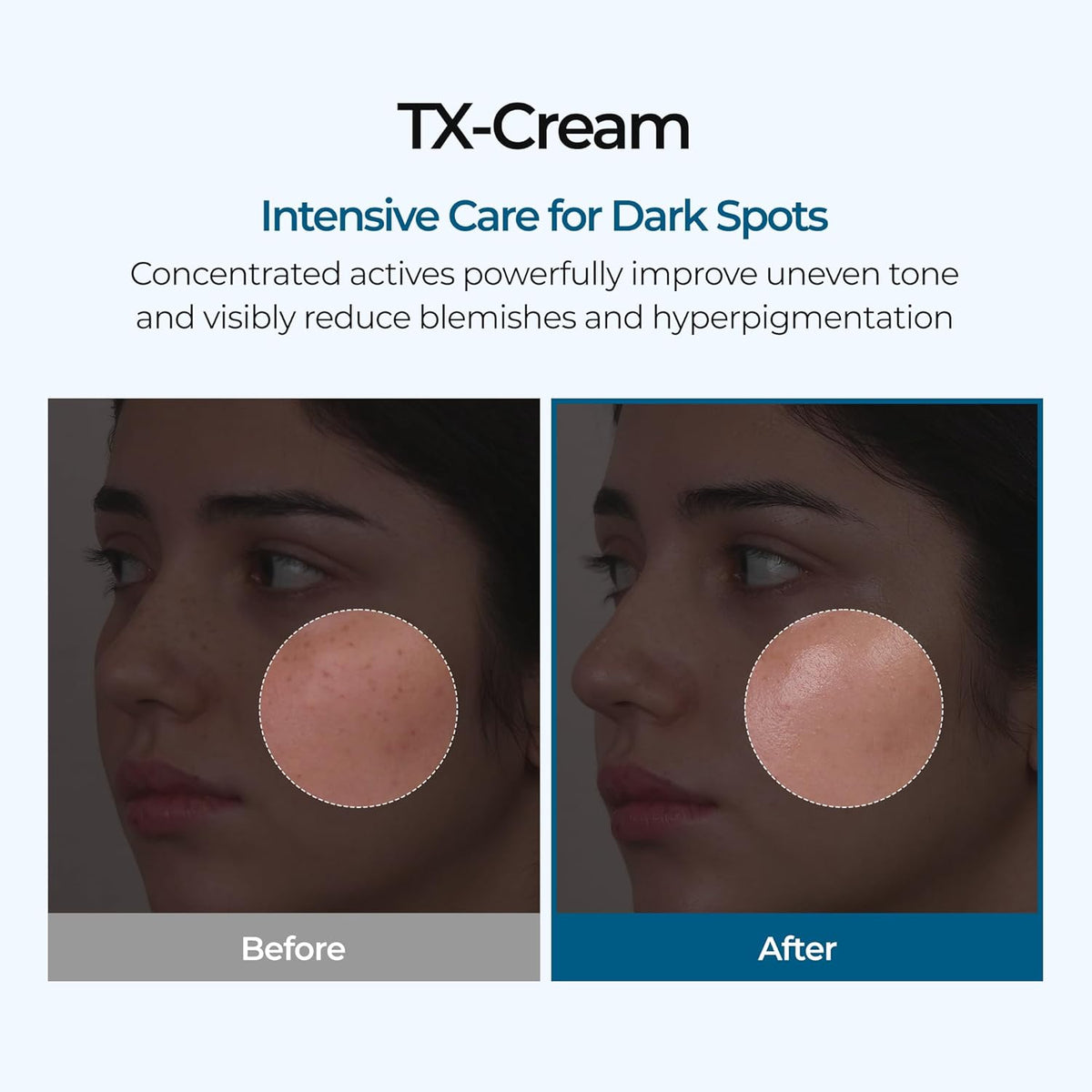 Advanced TX Tone Correcting Cream