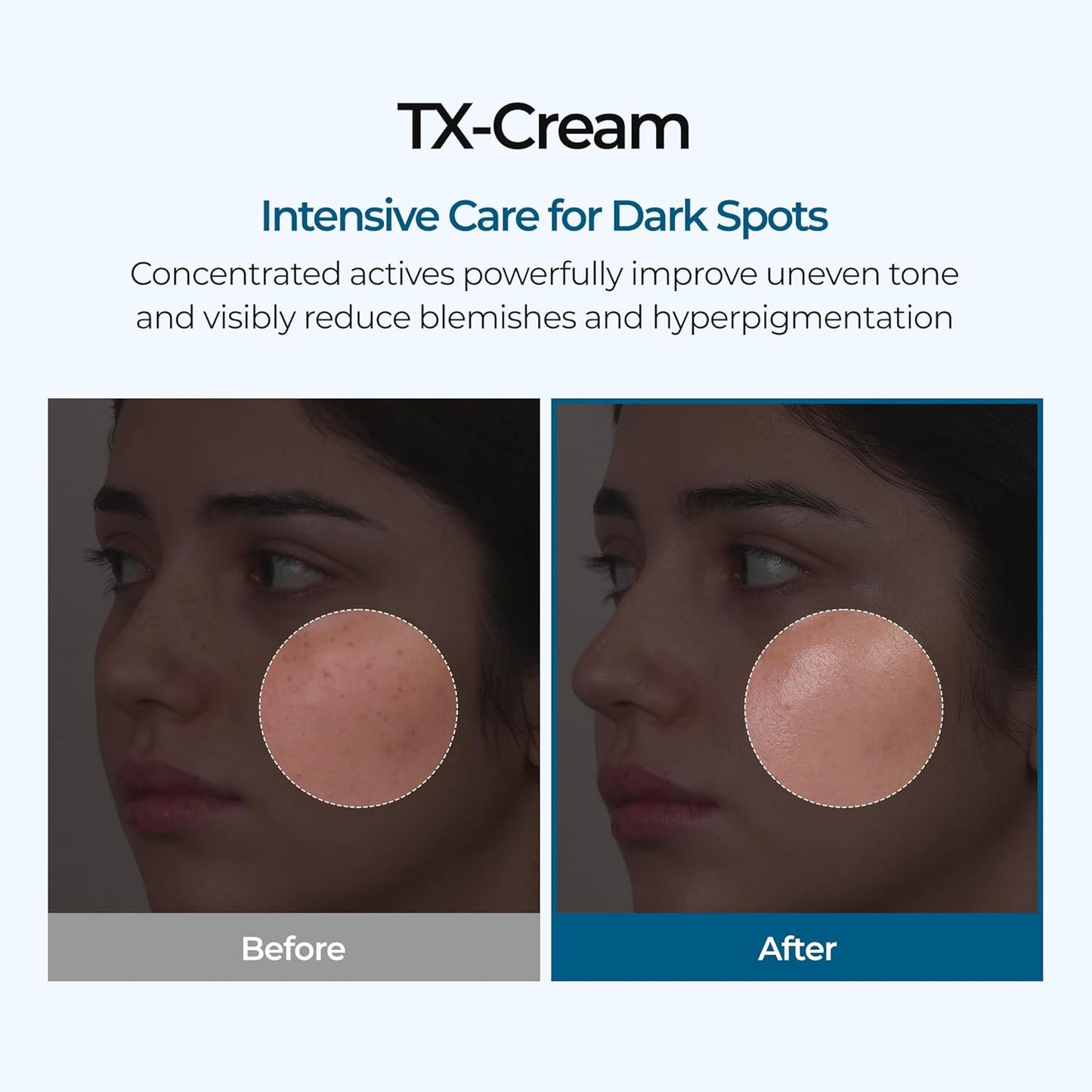 Advanced TX Tone Correcting Cream