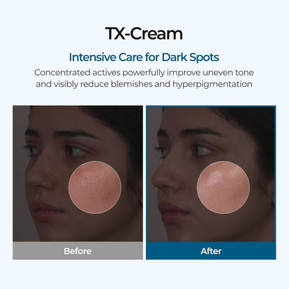 Advanced TX Tone Correcting Cream