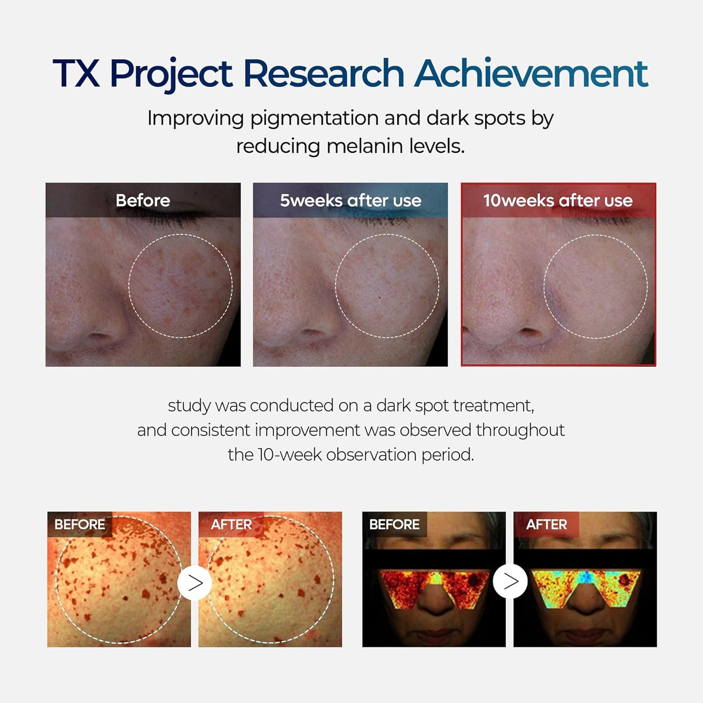 Advanced TX Tone Correcting Cream